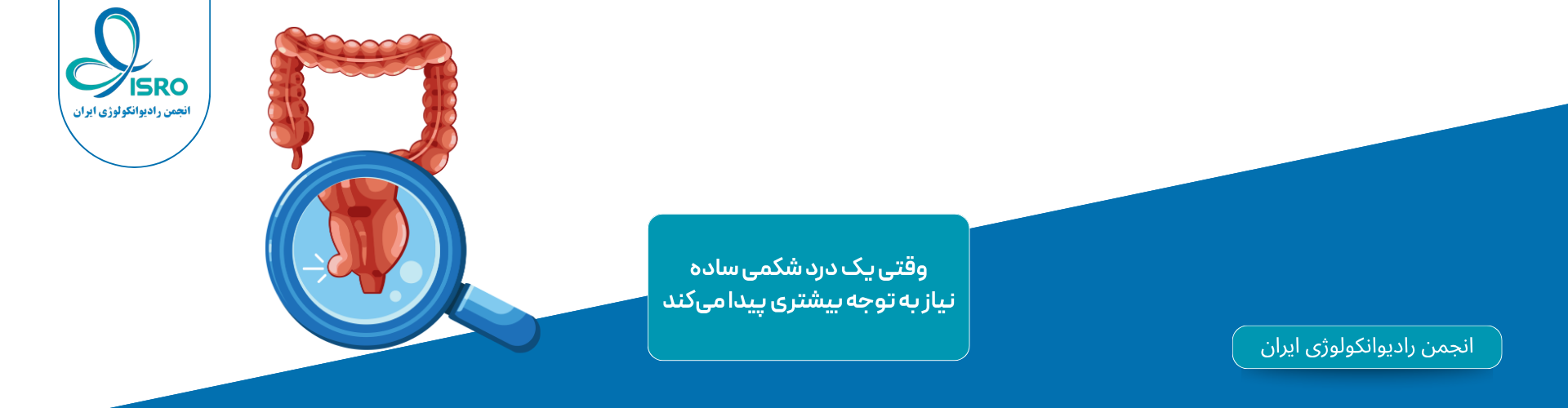 سرطان آپاندیس